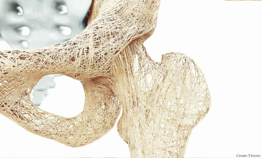 bone_blog