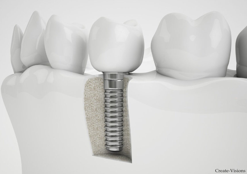 tooth_blog